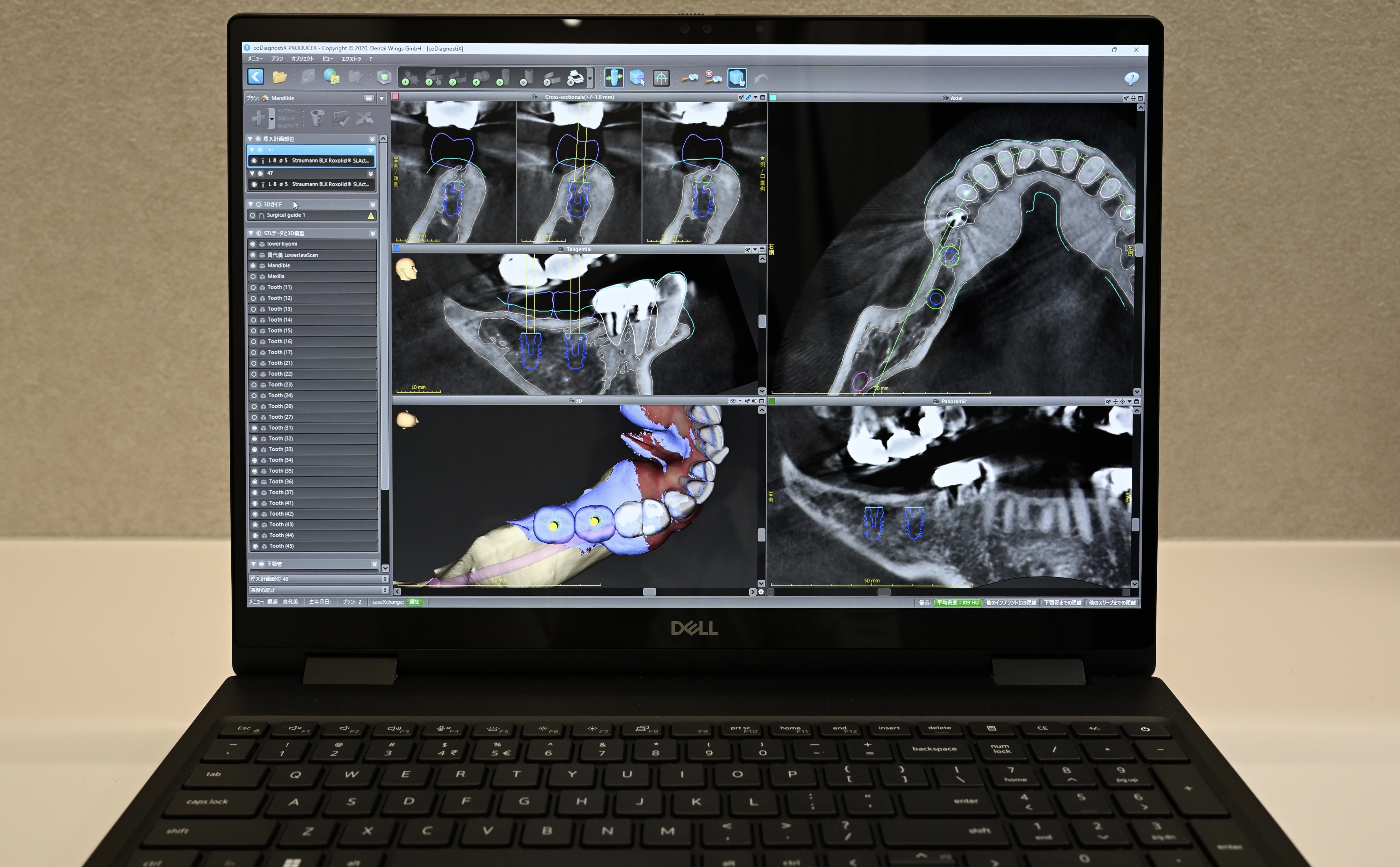 Cone-beam CT scanner at Eden Dental Office Nagoya for implant diagnosis