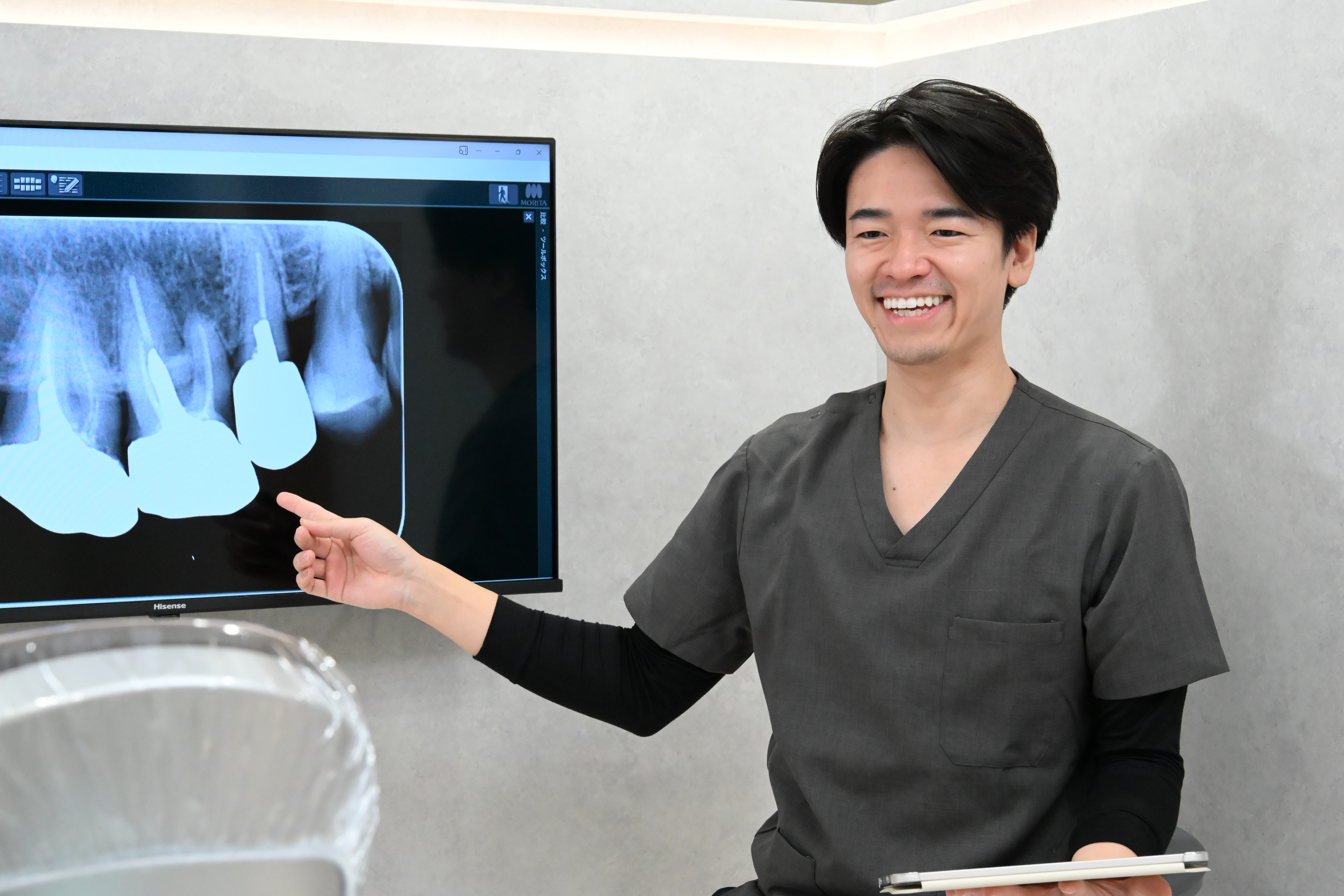 3D-printed surgical guide for guided implant surgery at Eden Dental Office