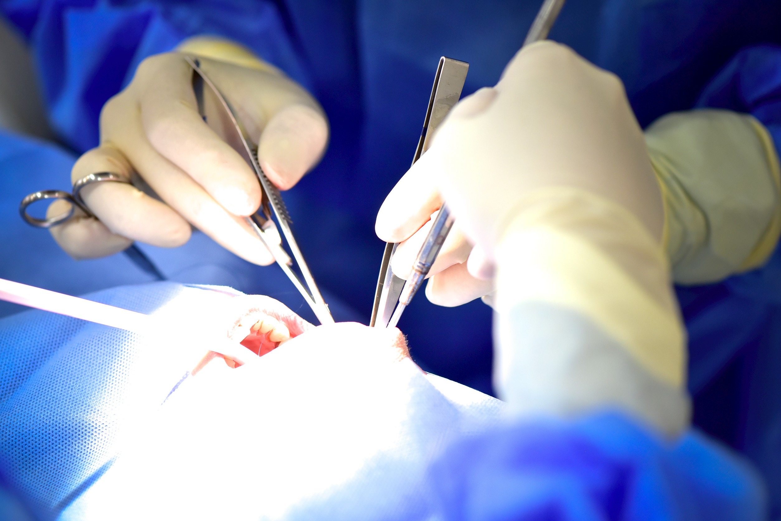 Live implant surgery performed by Dr. Murai at Eden Dental Office Nagoya