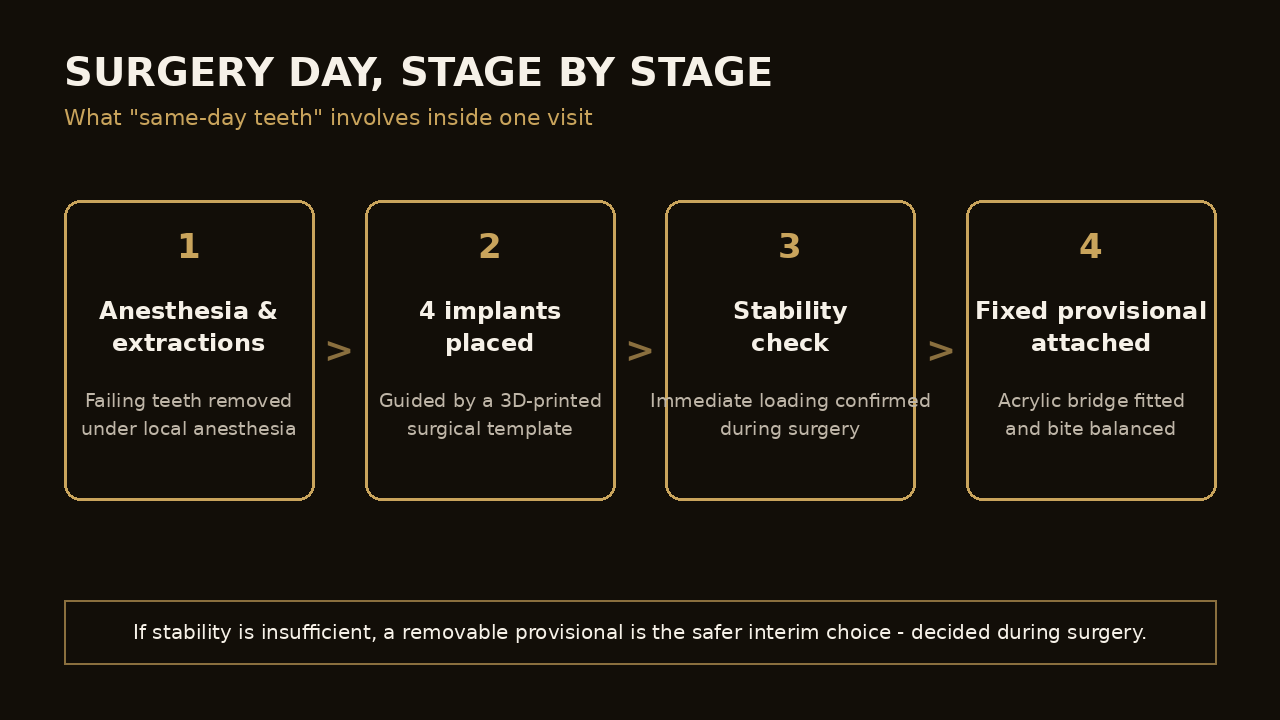 Diagram of the stages of All-on-4 surgery day from anesthesia to fixed provisional bridge | Eden Dental Office Nagoya