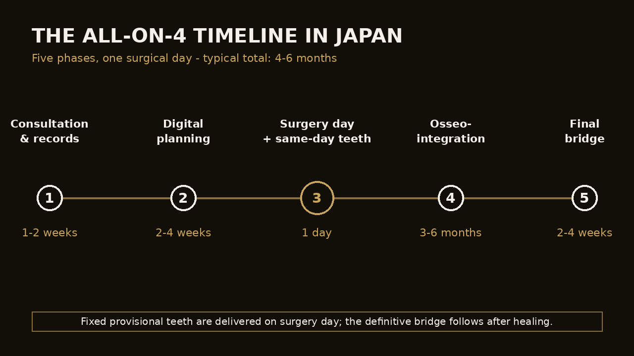 Timeline diagram of the five All-on-4 treatment phases in Japan from CT scan to final bridge | Eden Dental Office Nagoya