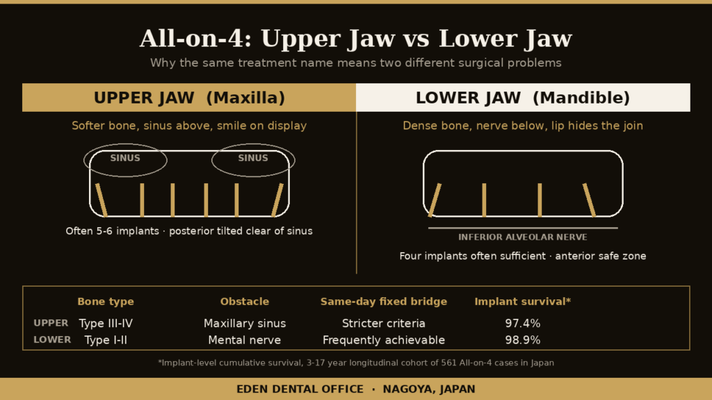 Diagram comparing All-on-4 in the upper jaw and lower jaw: bone density, sinus, nerve and implant number | Eden Dental Office Nagoya