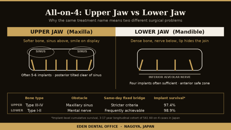 Diagram comparing All-on-4 in the upper jaw and lower jaw: bone density, sinus, nerve and implant number | Eden Dental Office Nagoya