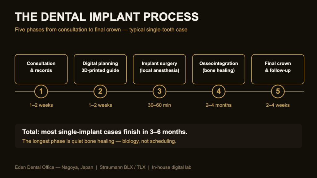 Five phases of the dental implant process timeline diagram | Eden Dental Office Nagoya