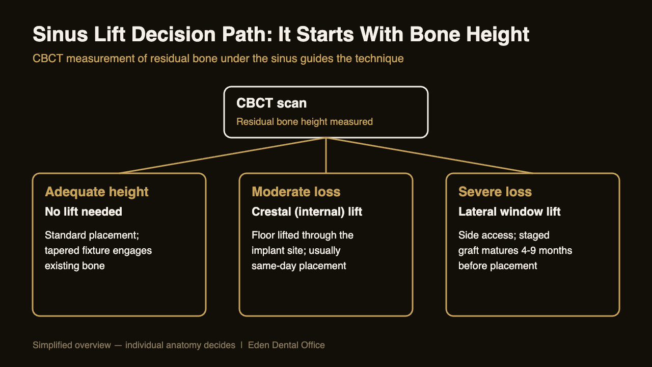 Decision path from residual bone height to crestal or lateral sinus lift technique | Eden Dental Office Nagoya