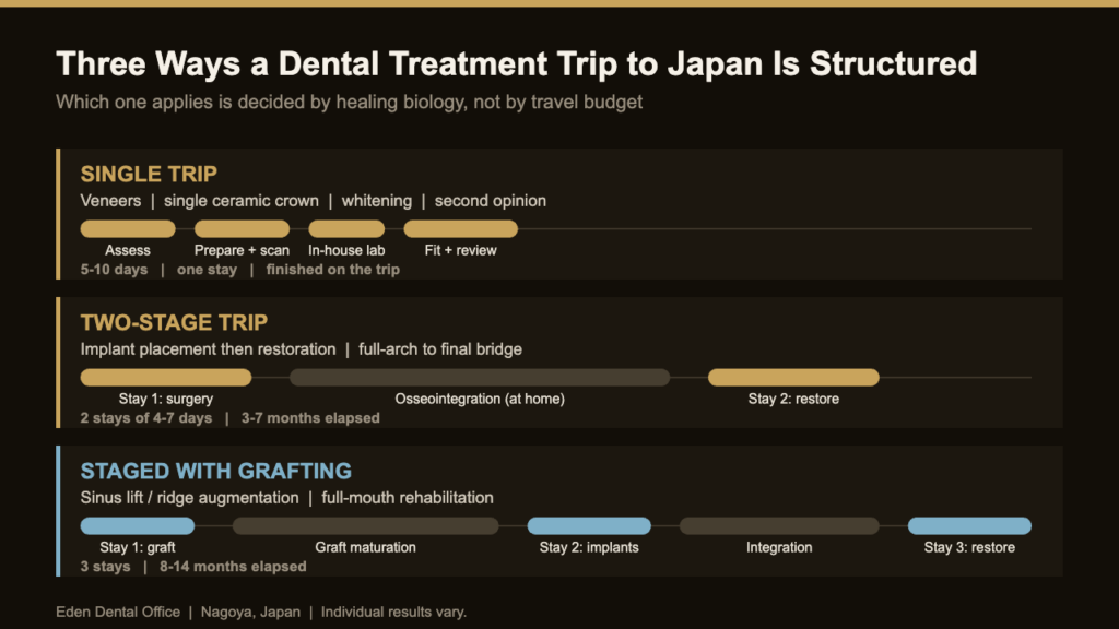 Three structures for a dental treatment trip to Japan: single trip, two-stage trip, and staged treatment with bone grafting | Eden Dental Office Nagoya