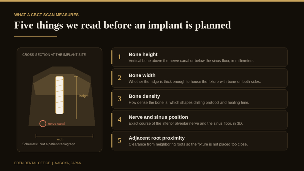 Five measurements a CBCT scan provides before dental implant placement | Eden Dental Office Nagoya