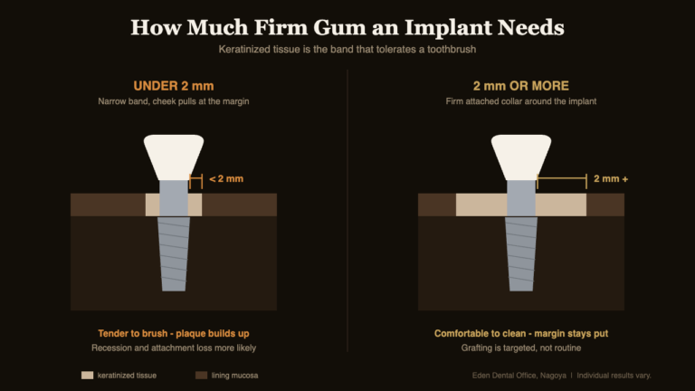 Cross-section comparing under 2 mm and 2 mm or more of keratinized tissue around a dental implant | Eden Dental Office Nagoya