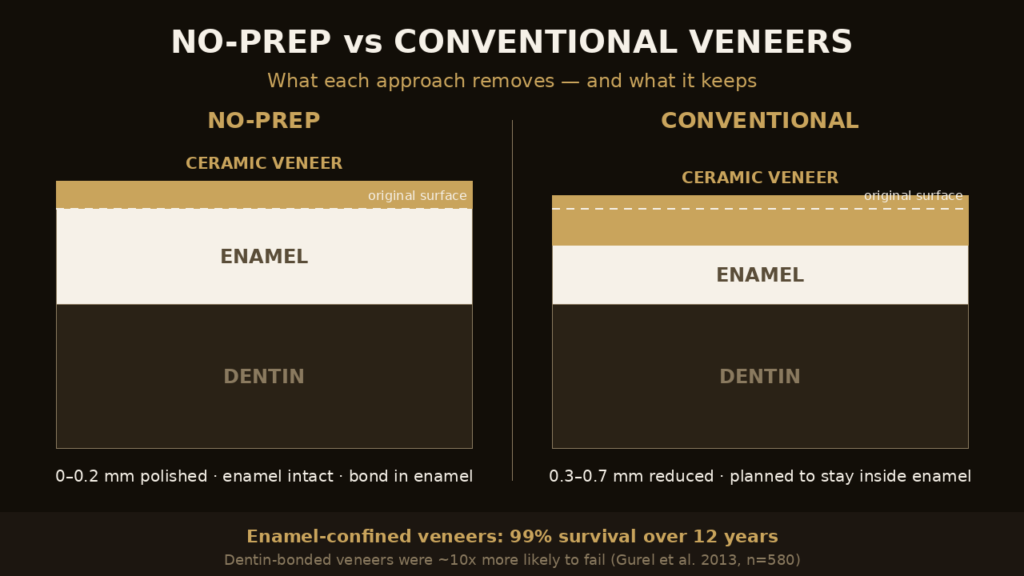 Cross-section comparison of enamel preserved by no-prep versus conventional veneer preparation | Eden Dental Office Nagoya