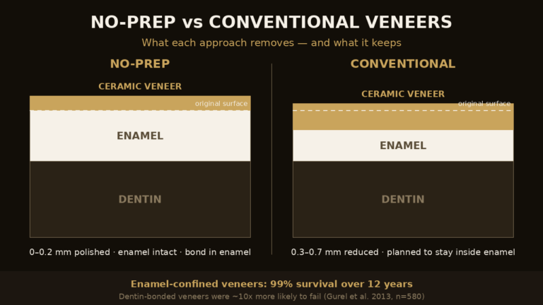 Cross-section comparison of enamel preserved by no-prep versus conventional veneer preparation | Eden Dental Office Nagoya
