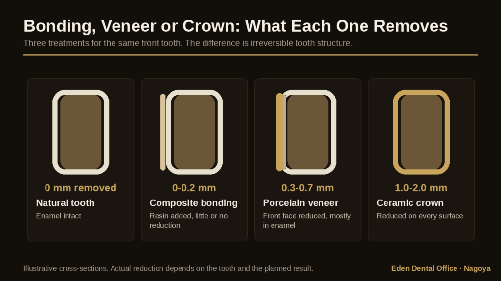 Cross-section comparison of how much tooth structure composite bonding, a porcelain veneer and a ceramic crown each remove | Eden Dental Office Nagoya