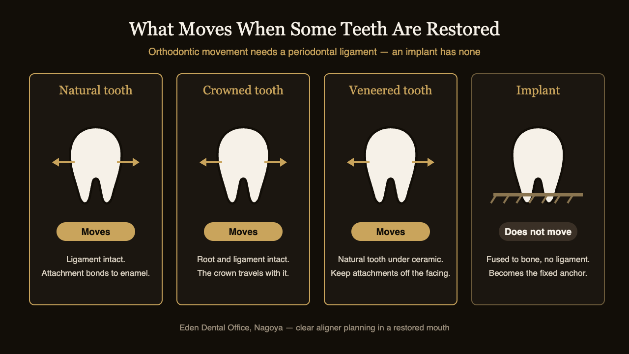 Chart comparing which restored teeth can move during clear aligner treatment and which cannot | Eden Dental Office Nagoya