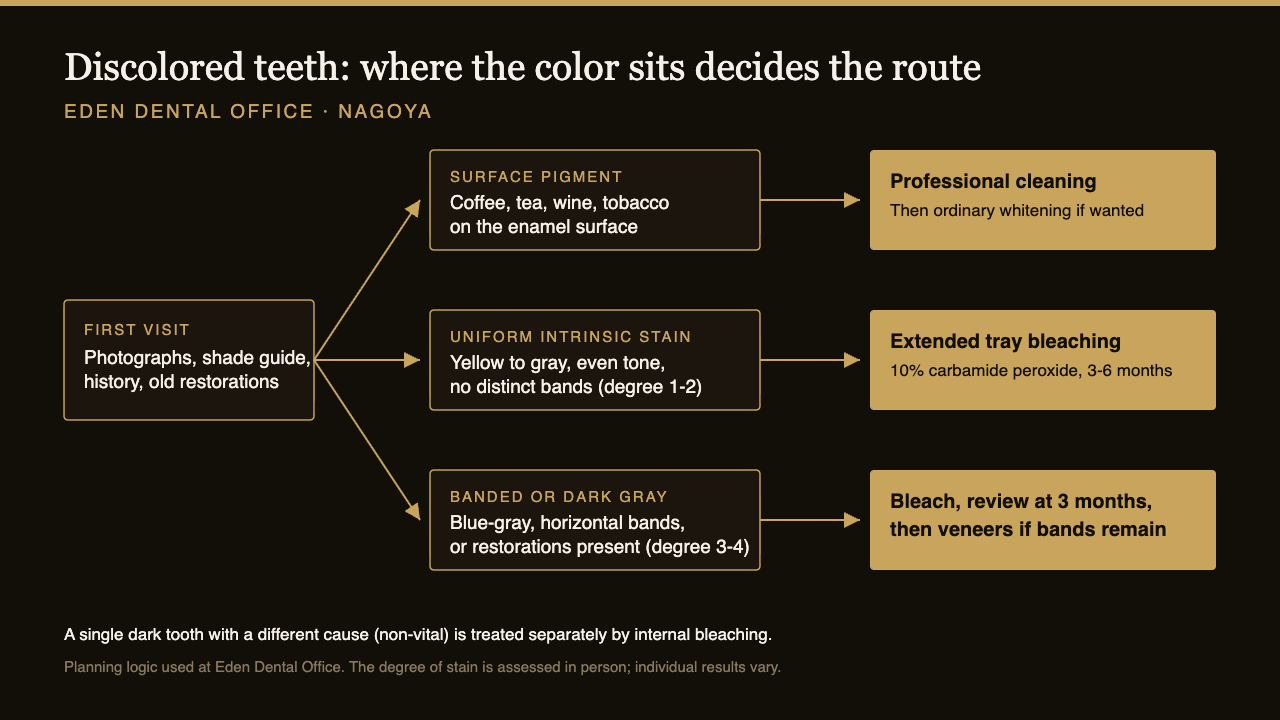 Decision path for discolored teeth in Japan: surface stain is cleaned, uniform intrinsic stain is bleached over months, banded or dark gray stain is bleached briefly then assessed for porcelain veneers | Eden Dental Office Nagoya