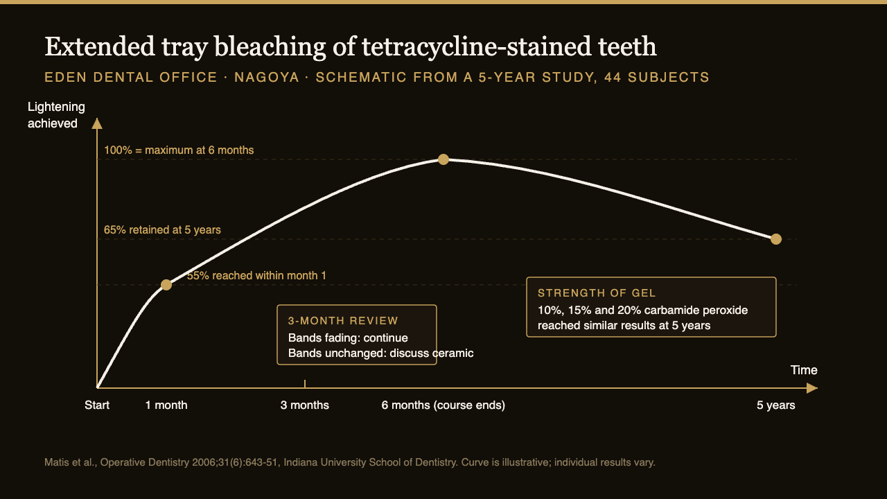 Diagram of extended tray bleaching for tetracycline-stained teeth: more than half the lightening arrives within the first month, the course runs about six months, and over 65 percent of the gain remains at five years | Eden Dental Office Nagoya