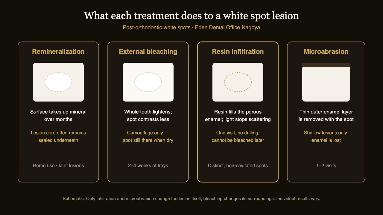 Diagram comparing four treatments for post-orthodontic white spot lesions: remineralization, external bleaching, resin infiltration and microabrasion, showing what each changes in the enamel | Eden Dental Office Nagoya