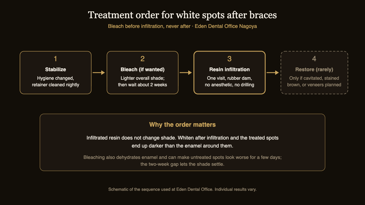 Flow diagram of the treatment order for white spots after braces: confirm hygiene and retainer care, whiten if a lighter shade is wanted, wait two weeks, resin infiltration, then restoration only if lesions are cavitated or stained | Eden Dental Office Nagoya