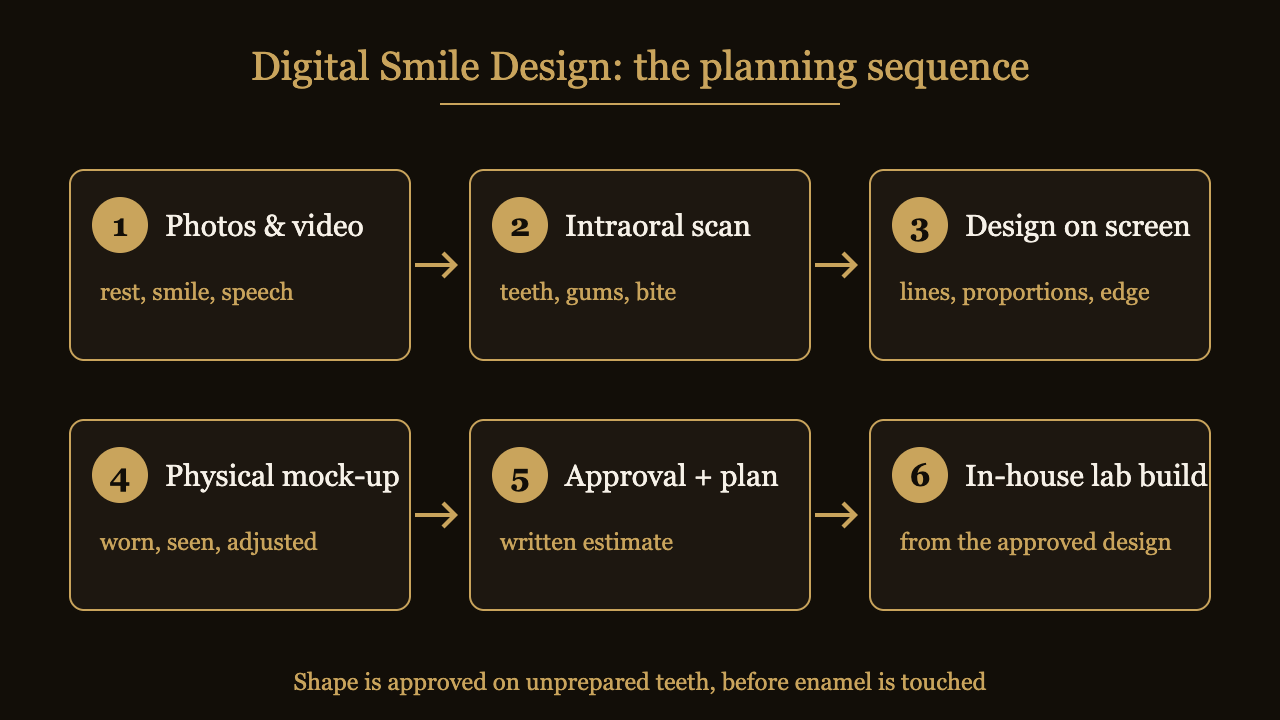 Six-stage Digital Smile Design planning sequence from photographs and scan to an approved physical mock-up and in-house laboratory build | Eden Dental Office Nagoya